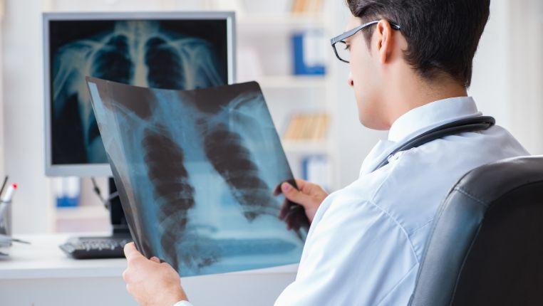 best lung cancer treatment in india